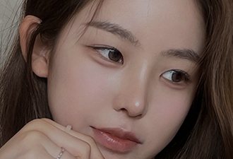 코수술+짧은코+비순각교정+복코+절골