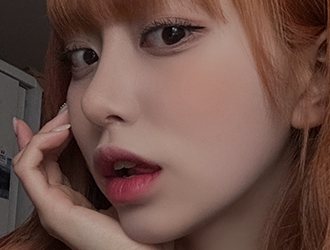 코수술+비순각교정+복코